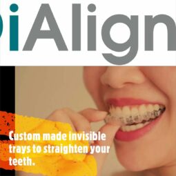 iAlign is the best and most affordable type of Aligners in Nepal